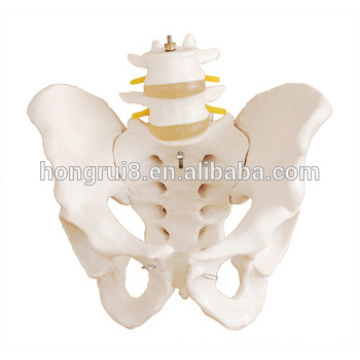 Human Pelvis Model with 2pcs Lumbar Vertebrae Model,Pelvic Floor Model